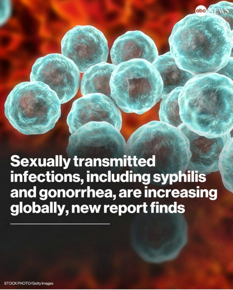 STIs, including syphilis, gonorrhea, increasing globally: The number of new syphilis cases rose to 8 million in 2022, the report found